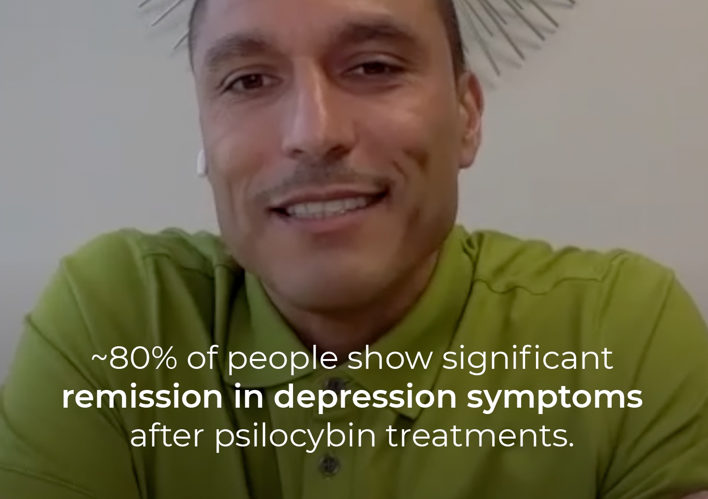 Anthony Gonzalez speaking during a Zoom interview with a text overlay: ~80% of people show significant remission in depression symptoms after psilocybin treatments.